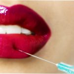 Коррекция губ гиалуроновой кислотой: красота без жертв
