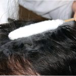 Криотерапия для волос: лечение жидким азотом