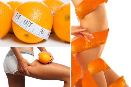 «Апельсиновая корка» не пропадет бесследно при снижении веса